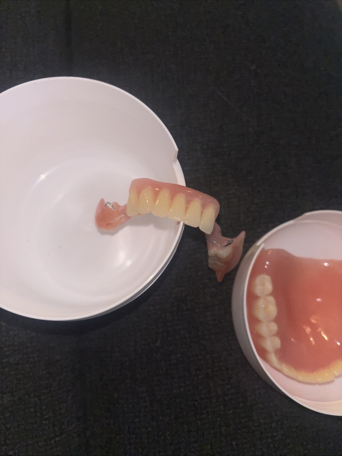Dentures & Bridge In Great Condition
