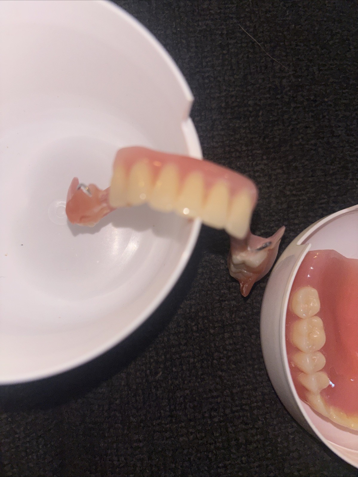 Dentures & Bridge In Great Condition